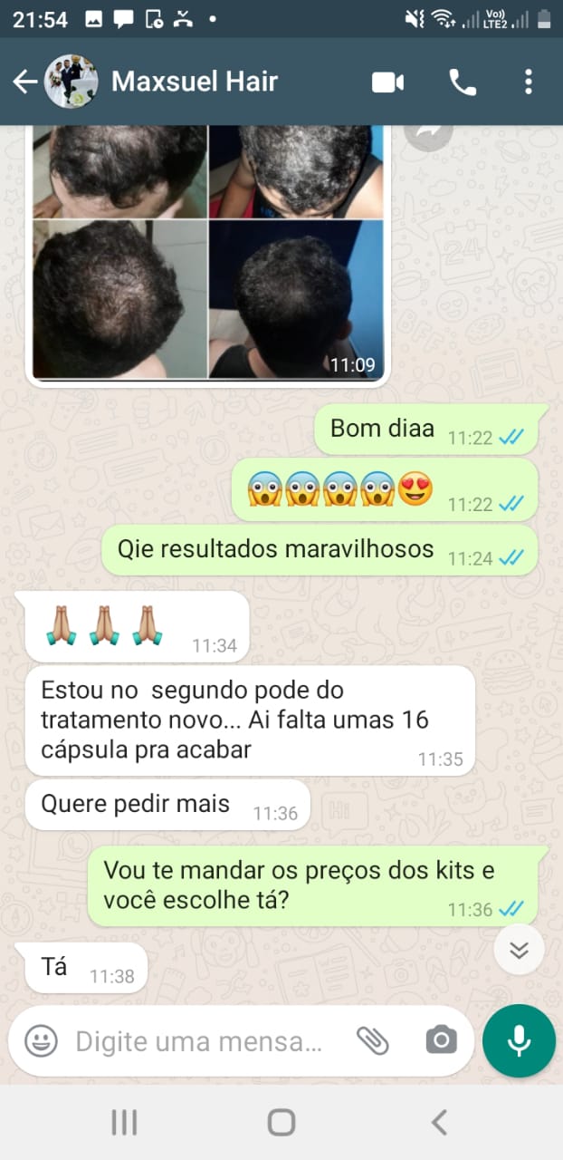 minoxidil em capsulas