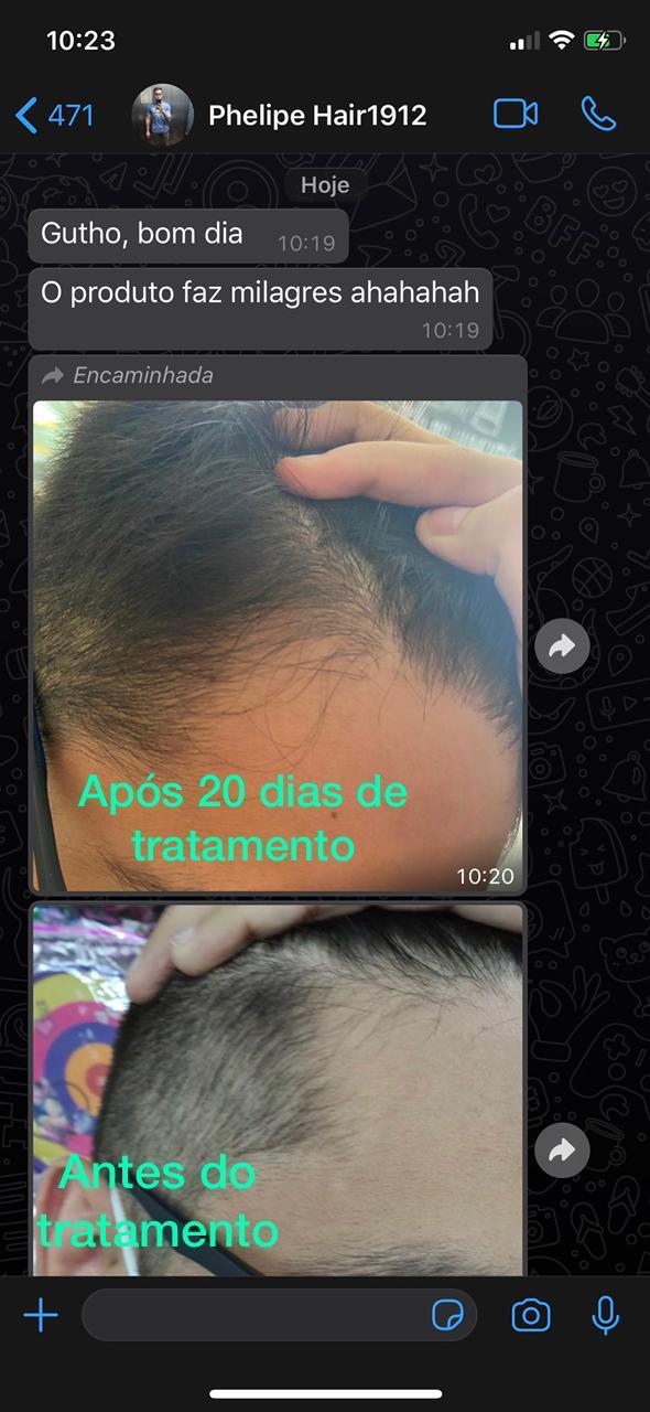 minoxidil em comprimido