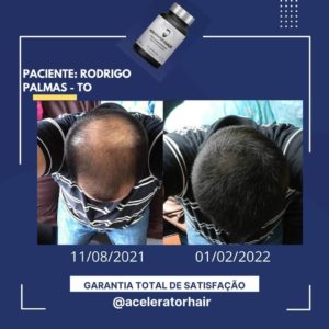 acelerator hair depoimentos