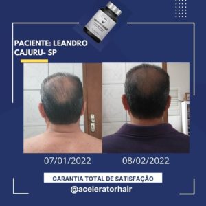 acelerator hair funciona