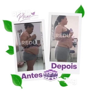 reduphine caps antes e depois